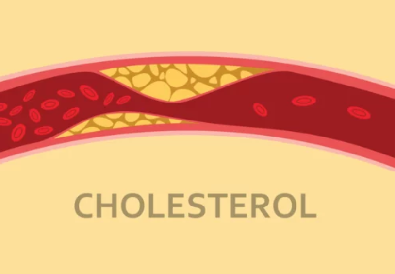 Cholesterol